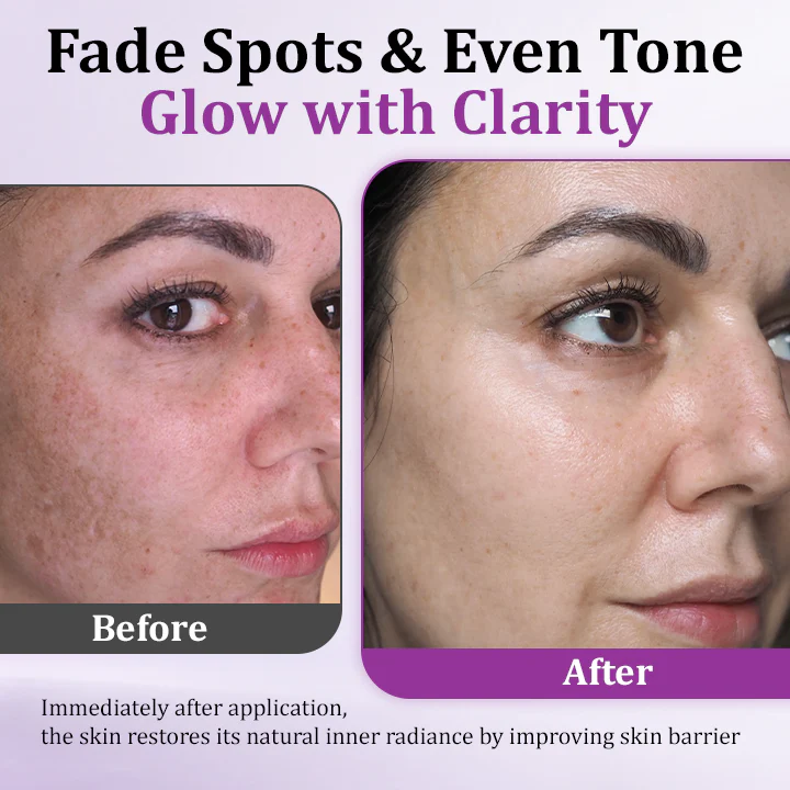 Fivfivgo® MelantraX Advanced Anti-Hyperpigmentation Essence