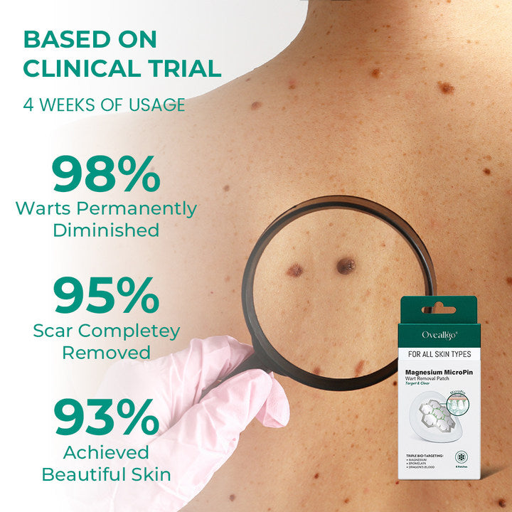 ✅Official Store: Oveallgo® Ultra Magnesium MicroPin Target & Clear Wart Removal Patch