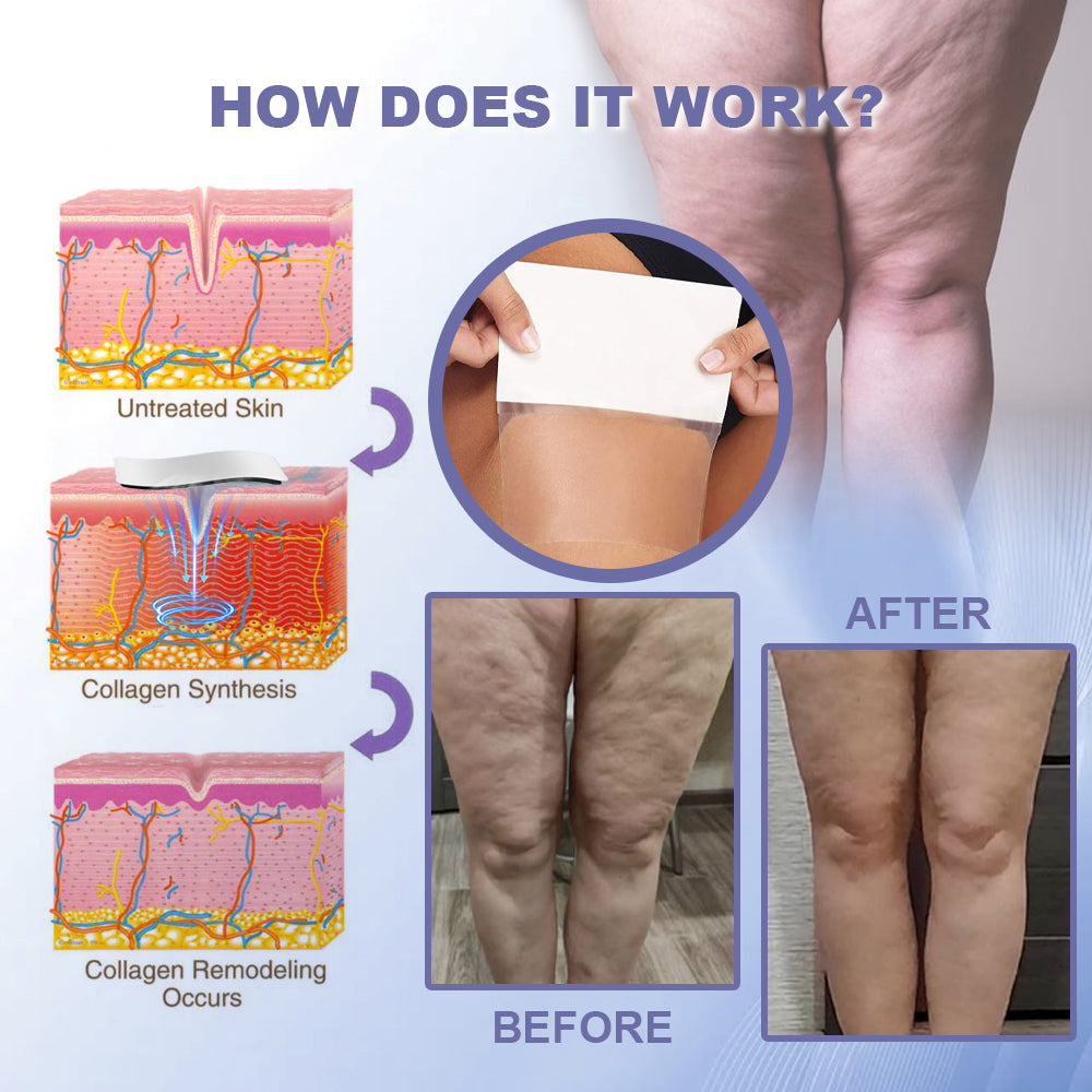 Oveallgo™ Slimming Invisible Leg Lift