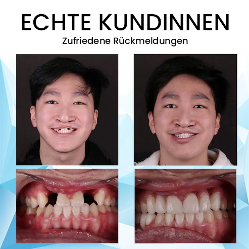 Oveallgo™ Siliconen Relining Prothese Set🦷