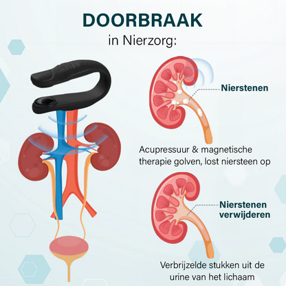 Oveallgo™ Magnetisch Nierverzorgingsclip