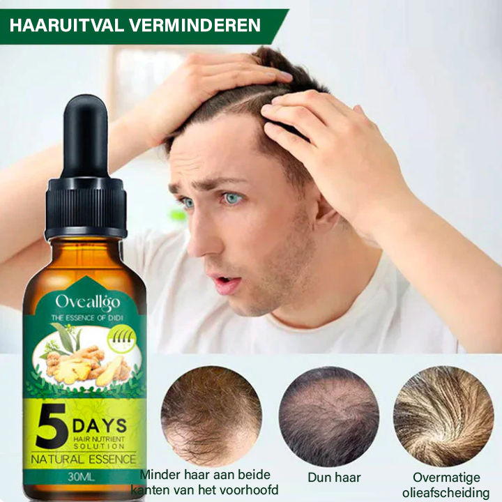 Oveallgo™ Shouga Essence Haargroeiolie