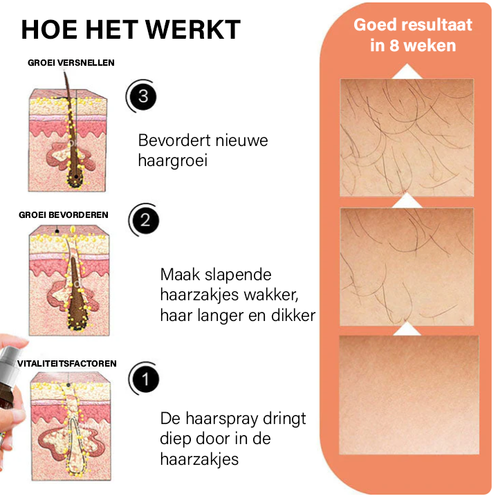 Oveallgo™ Ashwagandha 4500 Haargroeispray